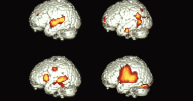 ¿Cómo puede un solo cerebro hablar dos idiomas? 