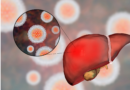 Promueve IMSS Veracruz Norte prevención y detección oportuna de hepatitis C